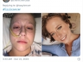 how-it-started-vs-how-its-going-tweets-cancer-survivors-2-5f88345478242__700