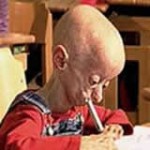 a66_progeria