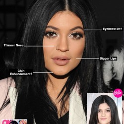kylie-jenner-before-after-plastic-surgery-gty-lead2