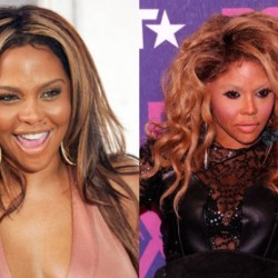 celebrity_surgeries_that_didnt_end_well_640_14