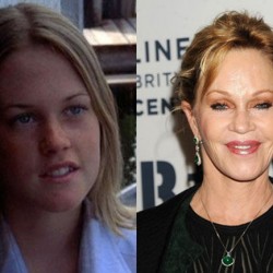celebrity_surgeries_that_didnt_end_well_640_18
