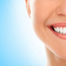 Teeth-Whitening1