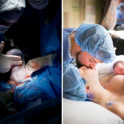 professional-birth-photography-competition-winners-labor-delivery-postpartum-16 (2)