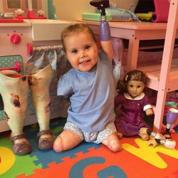 2-year-old-girl-got-legs-arms-amputated-gets-doll-look-just-like-her-1