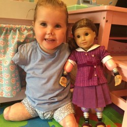 2-year-old-girl-got-legs-arms-amputated-gets-doll-look-just-like-her-2