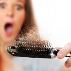 seborrheic-dermatitis-hair-loss