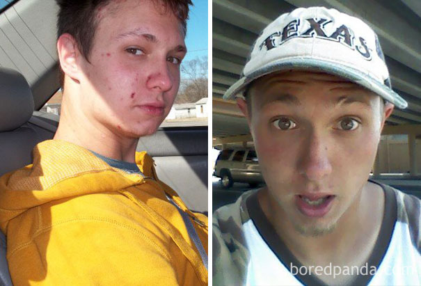 before-after-drug-addiction-3-585b9d1a97949__605