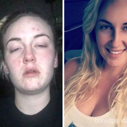 before-after-drug-addiction-54-585d1b2a0fb13__605