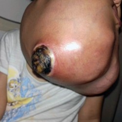 PAY-GIANT-TUMOUR-REMOVED-FROM-KID (2)