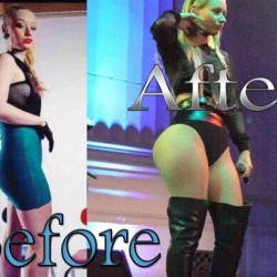 iggy-azalea-plastic-surgery-before-and-after