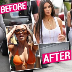 kim-kardashian-plastic-surgery-boobs-butt-reduction-before-after-pics-pp-