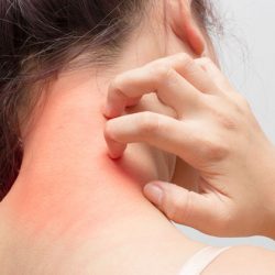 6-warning-signs-that-indicate-your-liver-is-full-of-toxins-3