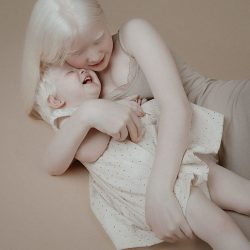 albino-sisters-photoshoot-kazakhstan-asel-kalaganova-1-5e27fc30dcbd8__700