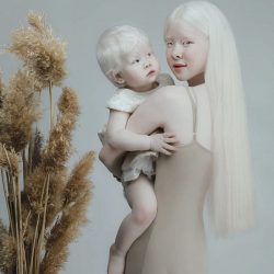 albino-sisters-photoshoot-kazakhstan-asel-kalaganova-10-5e27fc415cc4b__700