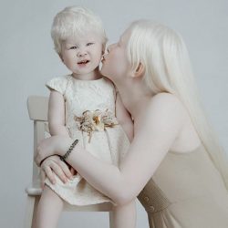 albino-sisters-photoshoot-kazakhstan-asel-kalaganova-2-5e27fc32c738a__700