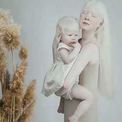 albino-sisters-photoshoot-kazakhstan-asel-kalaganova-3-5e27fc346f7ab__700