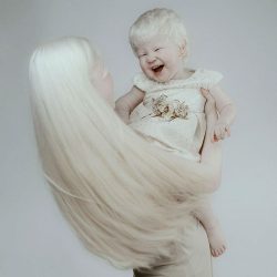 albino-sisters-photoshoot-kazakhstan-asel-kalaganova-5-5e27fc3964a03__700