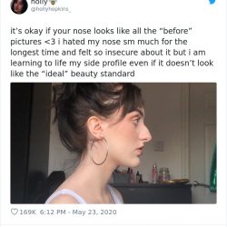 noses-look-like-before-photos-1