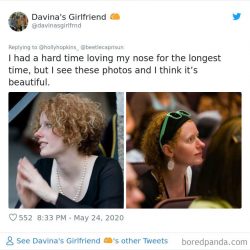 noses-look-like-before-photos-502-5ecfad5cb3b25__700