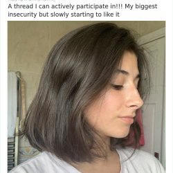 noses-look-like-before-photos-505-5ecfaee4b728d__700