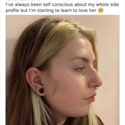 noses-look-like-before-photos-508-5ecfb0f12eea9__700