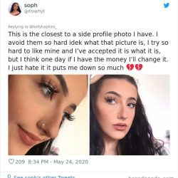 noses-look-like-before-photos-512-5ecfb44ec07bd__700