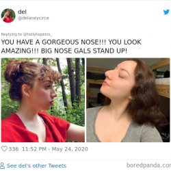 noses-look-like-before-photos-515-5ecfb5645e055__700