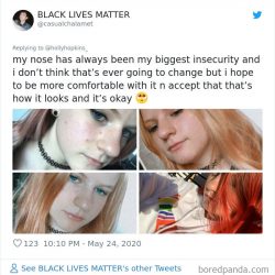 noses-look-like-before-photos-518-5ecfb63f527eb__700