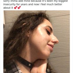 noses-look-like-before-photos-523-5ecfb854c3137__700